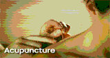 Radio Art - Acupuncture